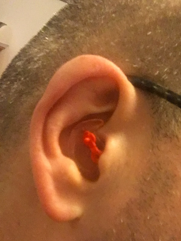 bouchon d'oreille ouvert à droite : Alvis Audio